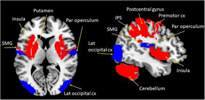 Peripersonal Space and Bodily Self-Consciousness: Implications for Psychological Trauma-Related Disorders